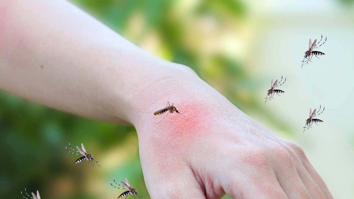 piqure de moustique enfant